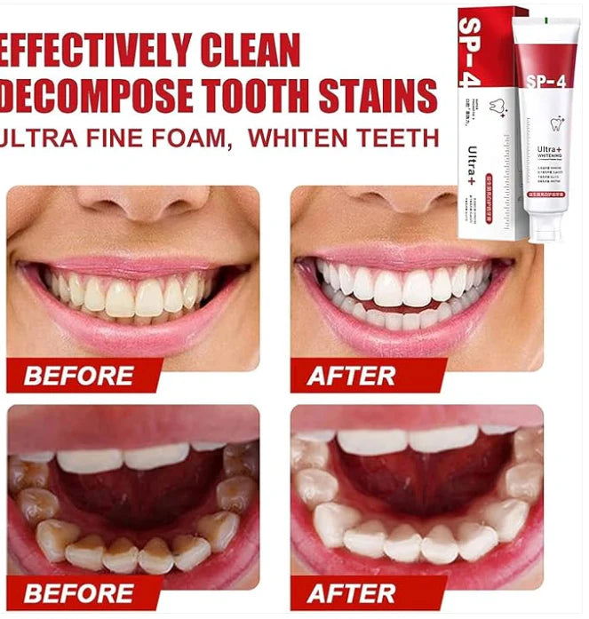 SP-4 ultra Whitening Probiotic Paste